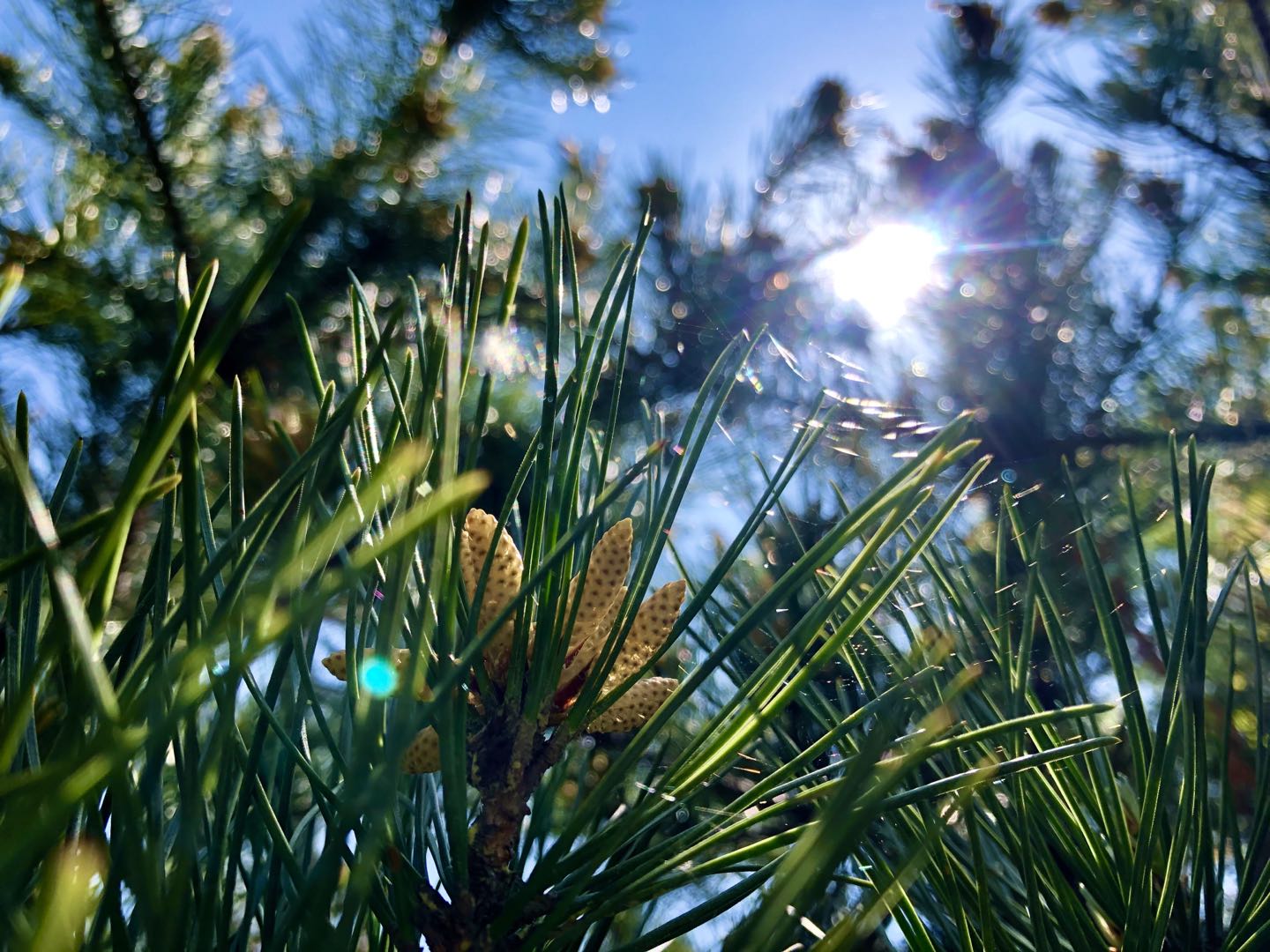 人體免疫球蛋白和補(bǔ)體檢測的意義